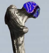 femur